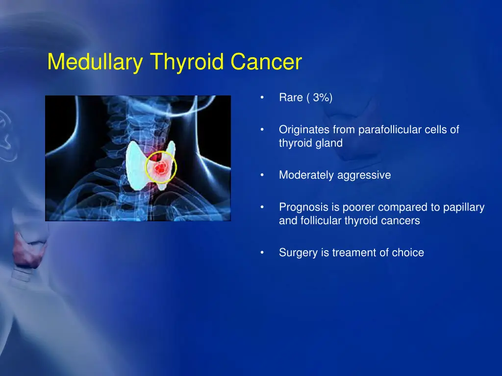 medullary thyroid cancer