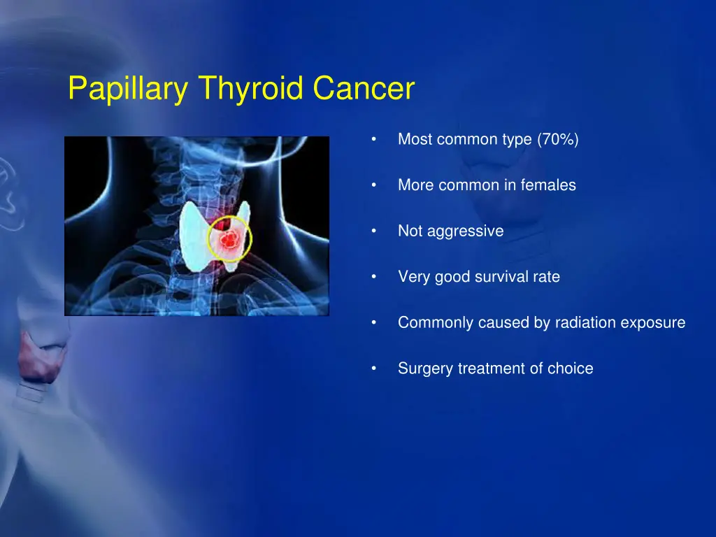 papillary thyroid cancer