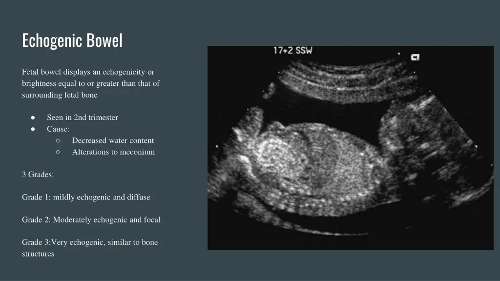 echogenic bowel