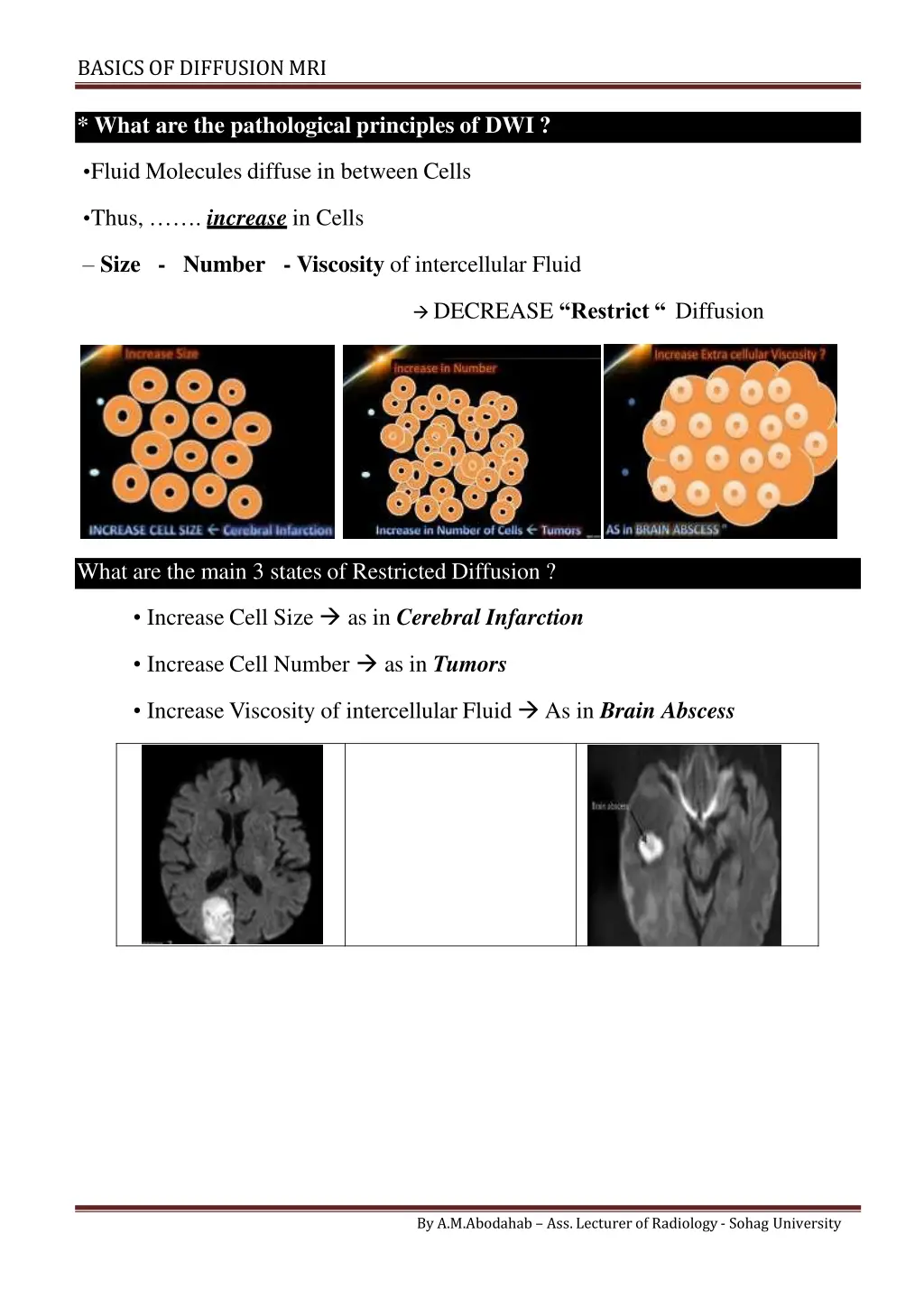 basics of diffusionmri 1