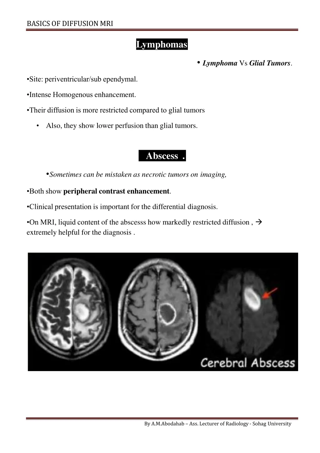 basics of diffusionmri 10