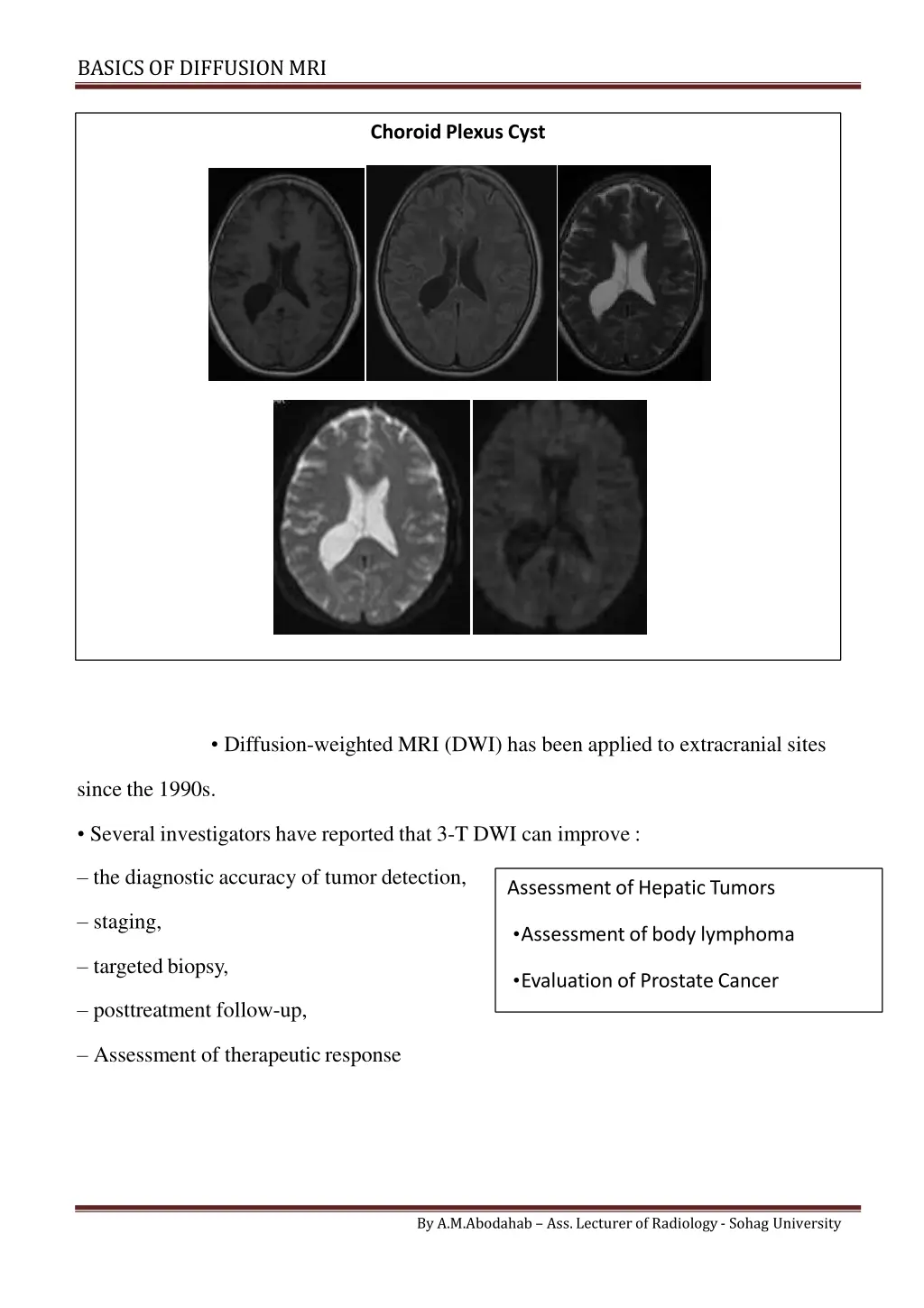 basics of diffusionmri 11