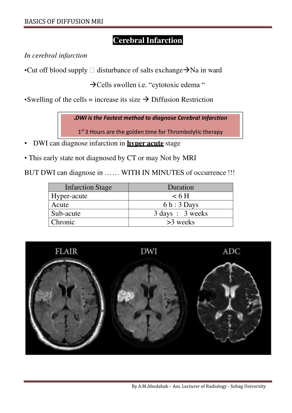 basics of diffusionmri 2