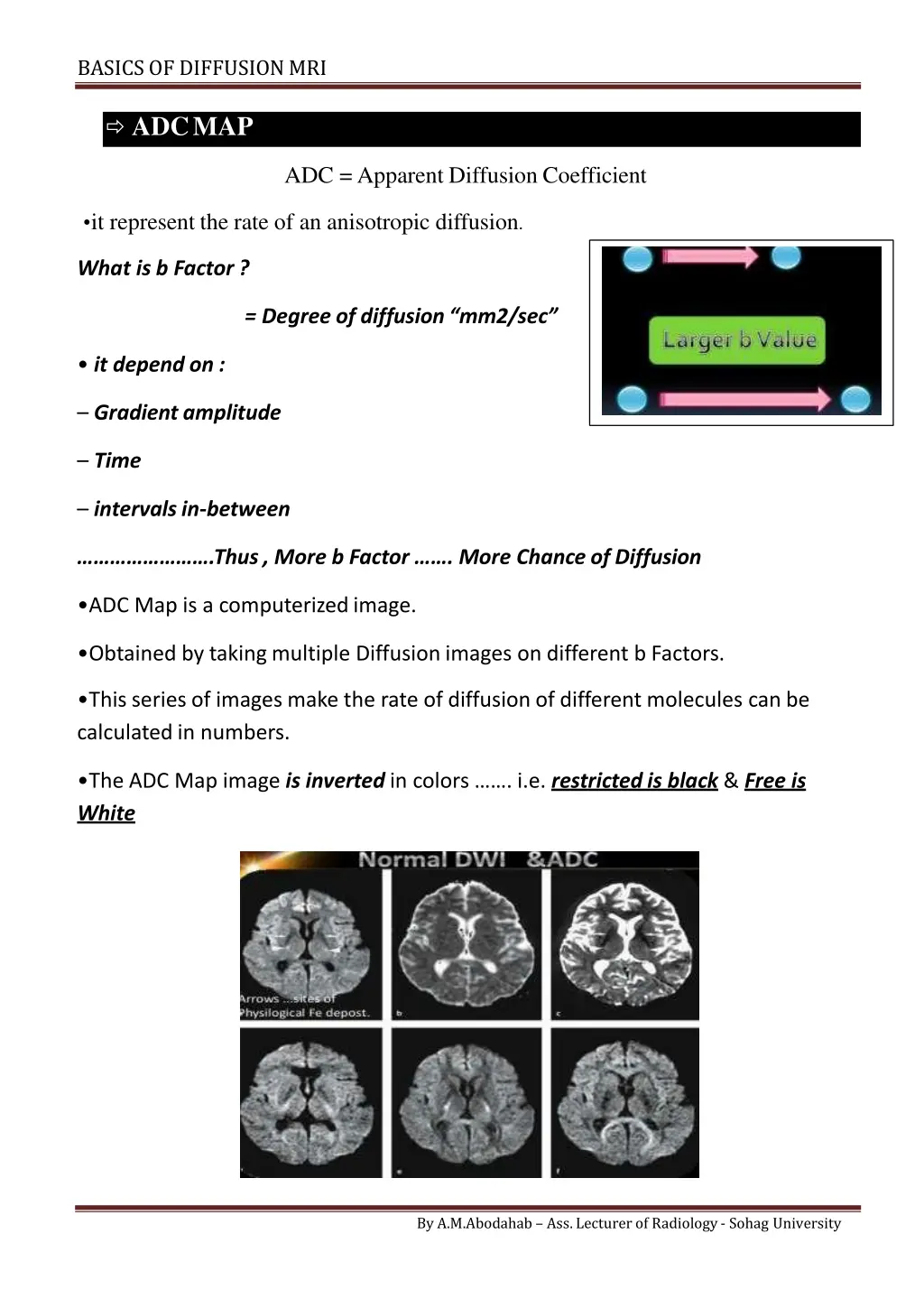 basics of diffusionmri 3