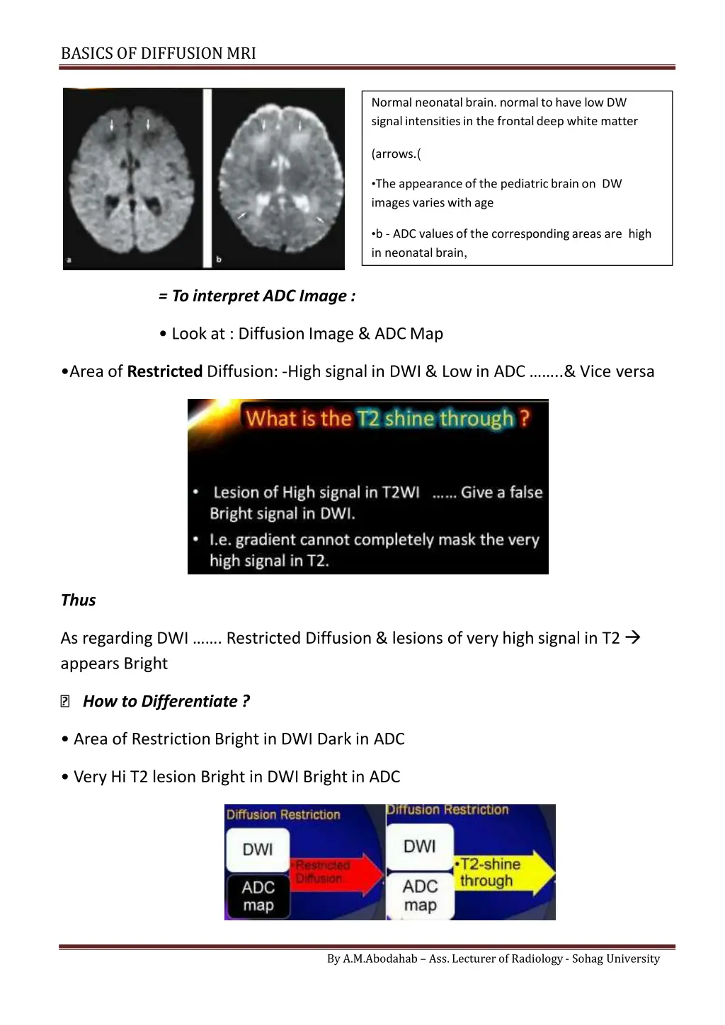 basics of diffusionmri 4