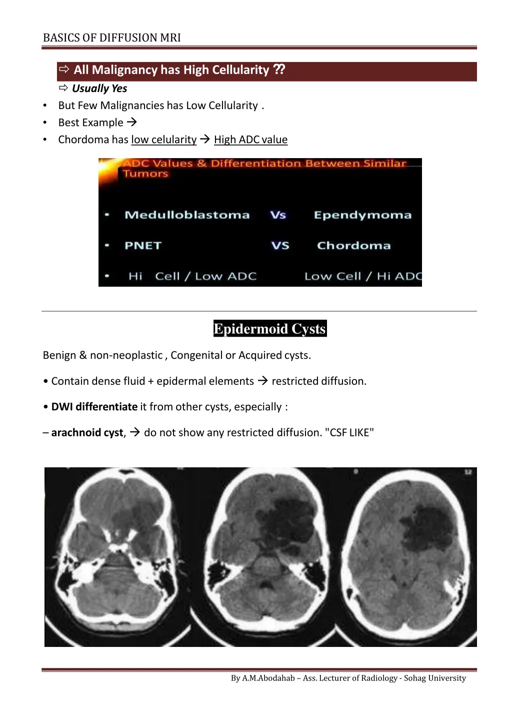 basics of diffusionmri 6