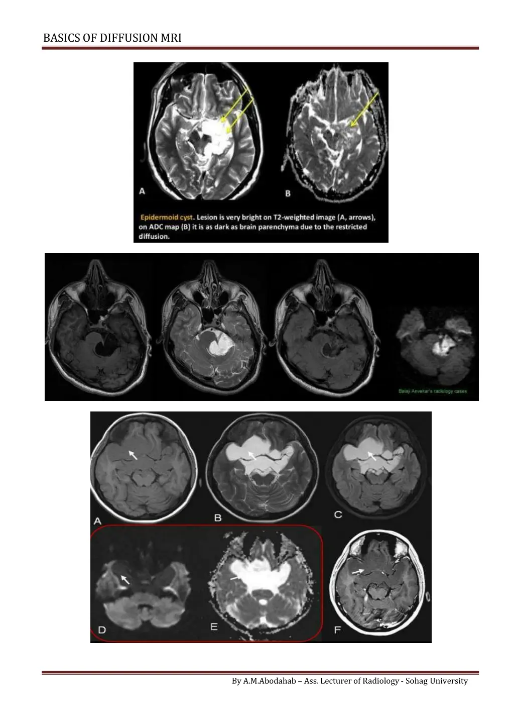 basics of diffusionmri 7