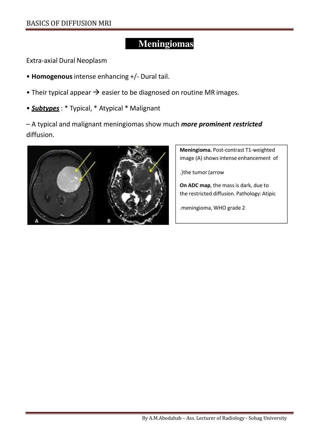 basics of diffusionmri 8