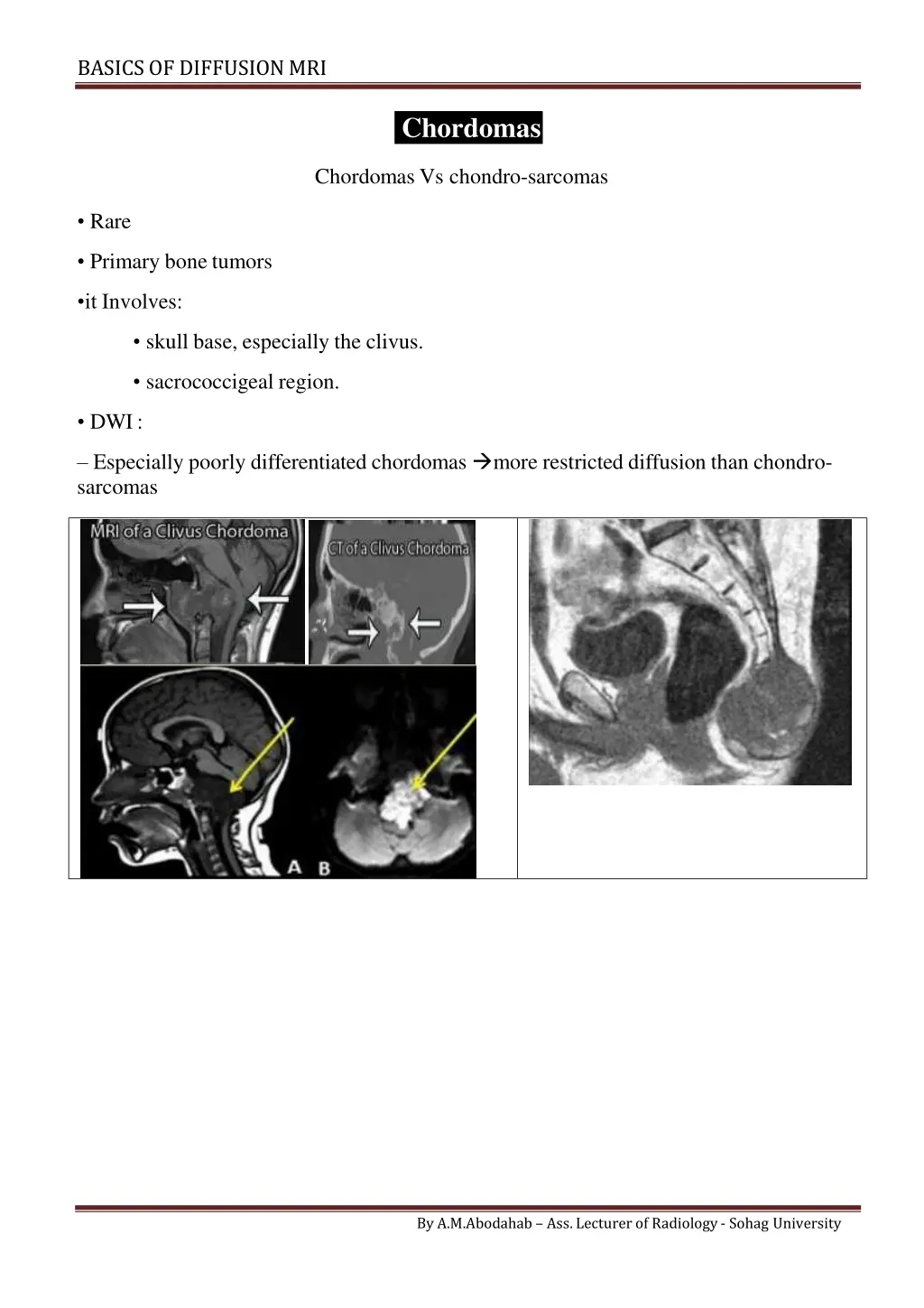 basics of diffusionmri 9