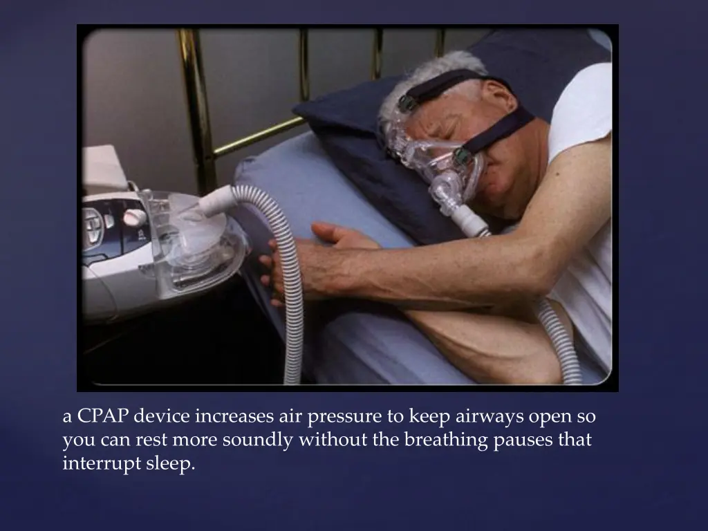 a cpap device increases air pressure to keep