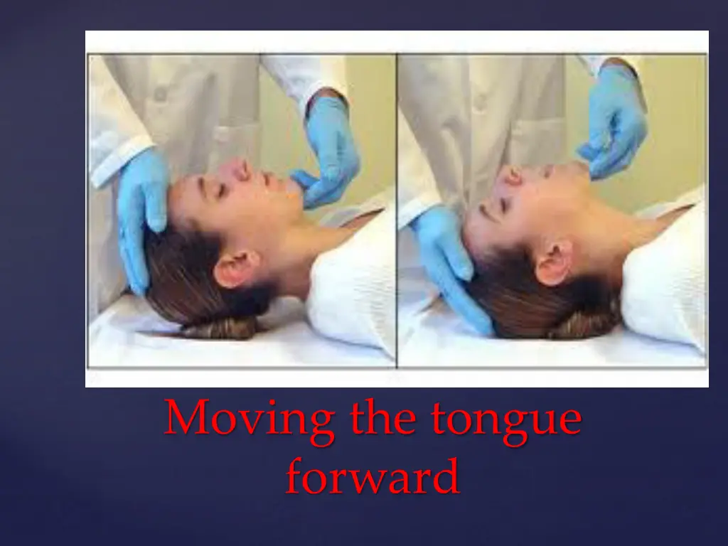 moving the tongue forward