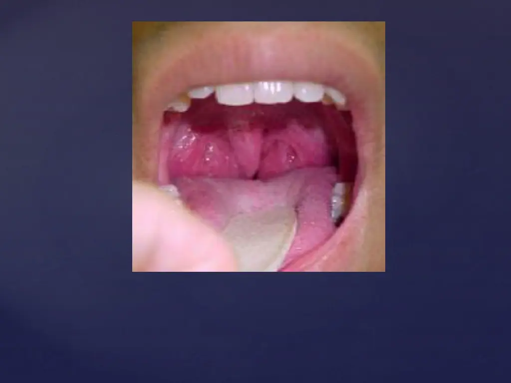 slide10