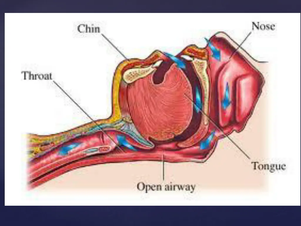 slide4