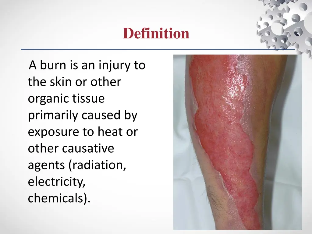 definition