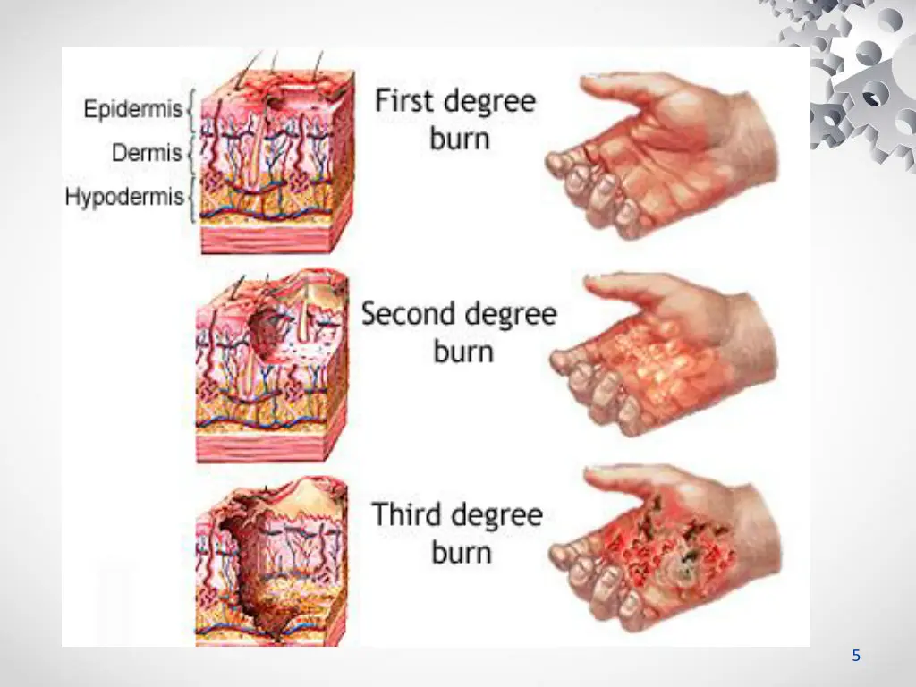 slide5