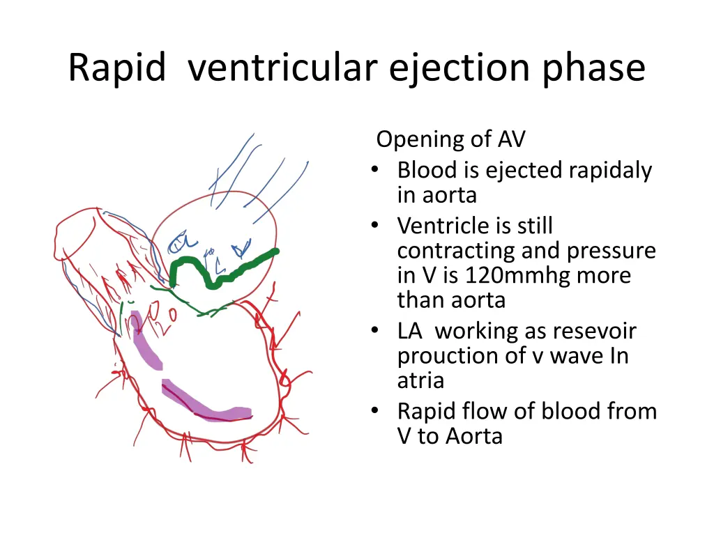 rapid ventricular ejection phase