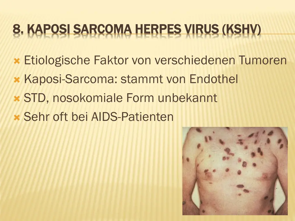 8 kaposi 8 kaposi sarcoma 1