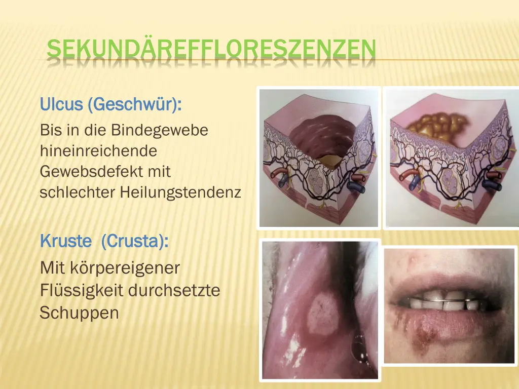 sekund reffloreszenzen