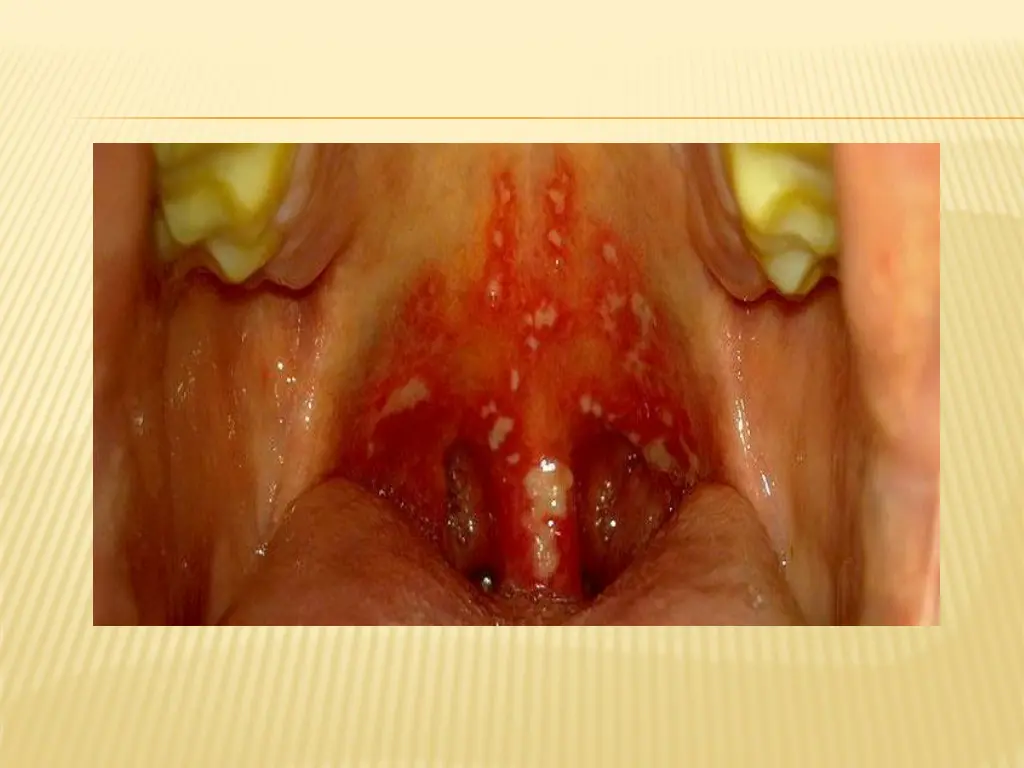 slide24