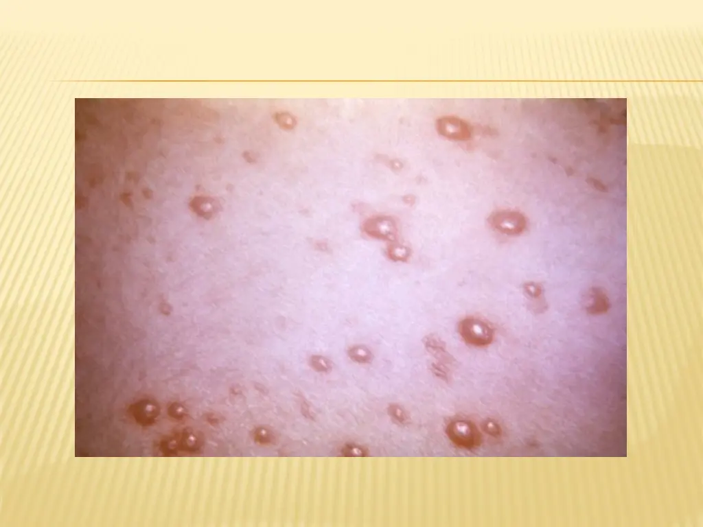 slide31