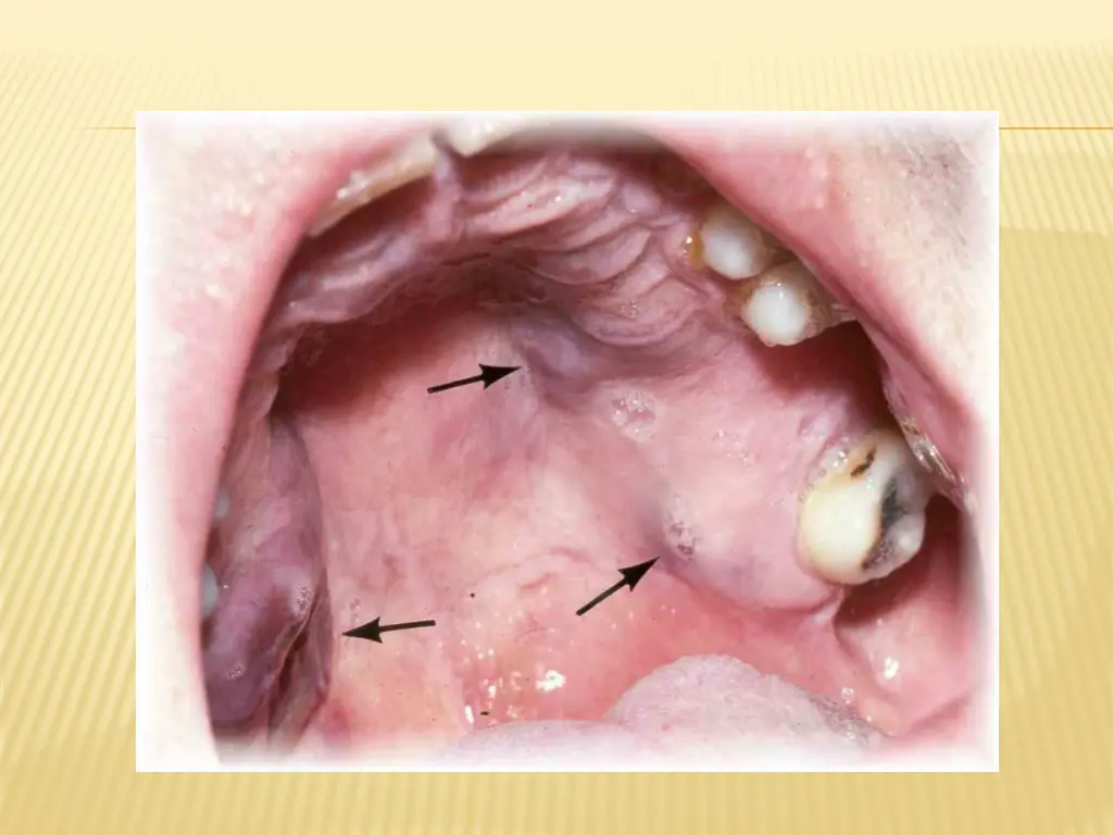 slide41