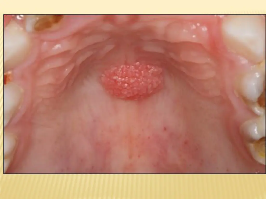 slide47