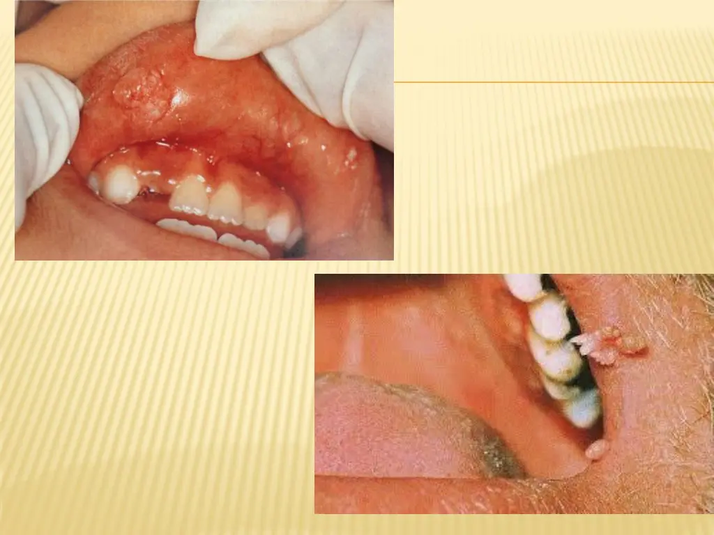 slide48