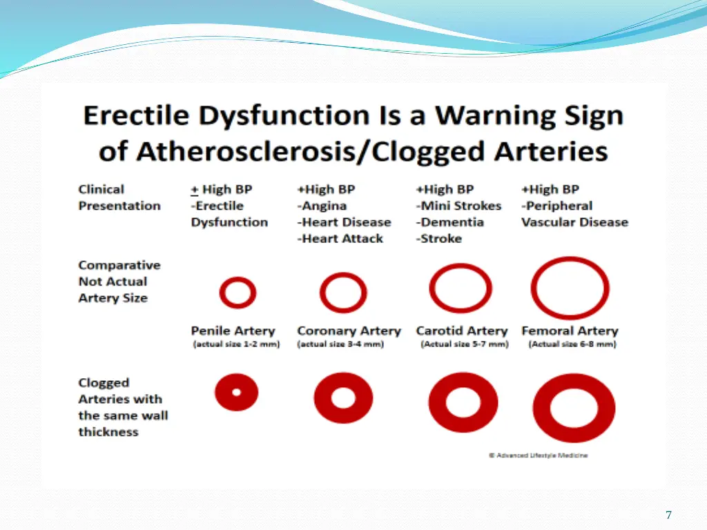 slide7
