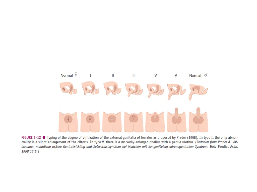 slide7