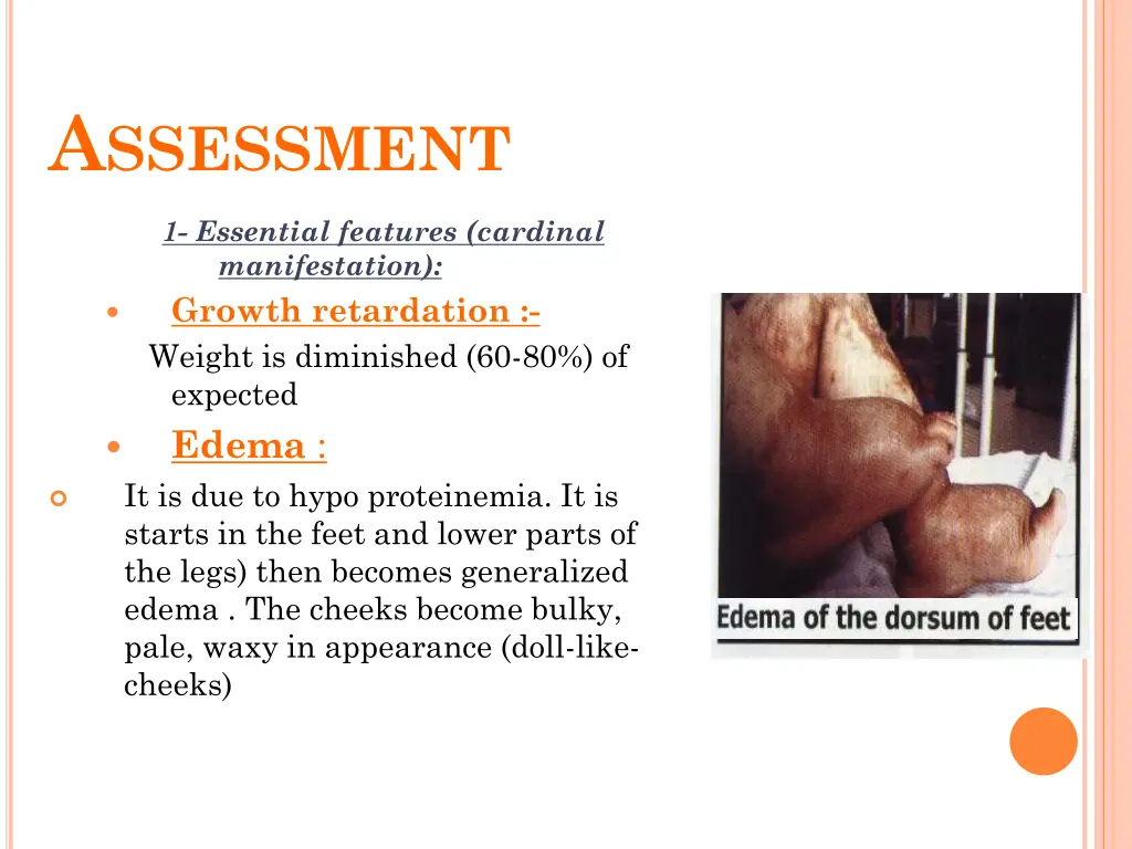 a ssessment