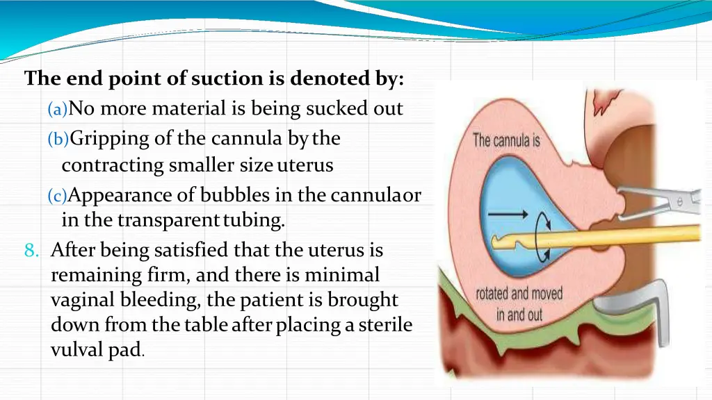 slide15