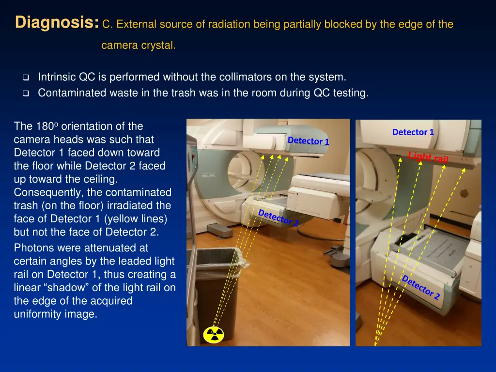 diagnosis c external source of radiation being