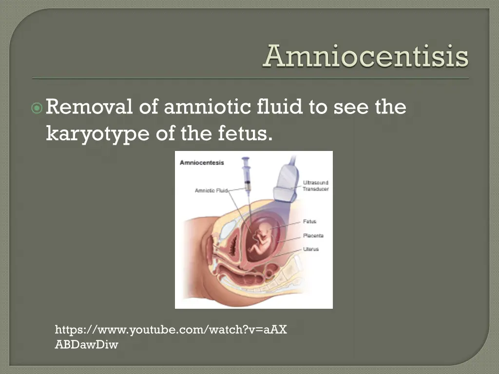 removal of amniotic fluid to see the karyotype