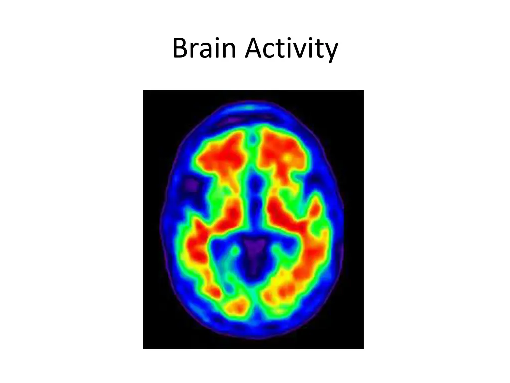 brain activity