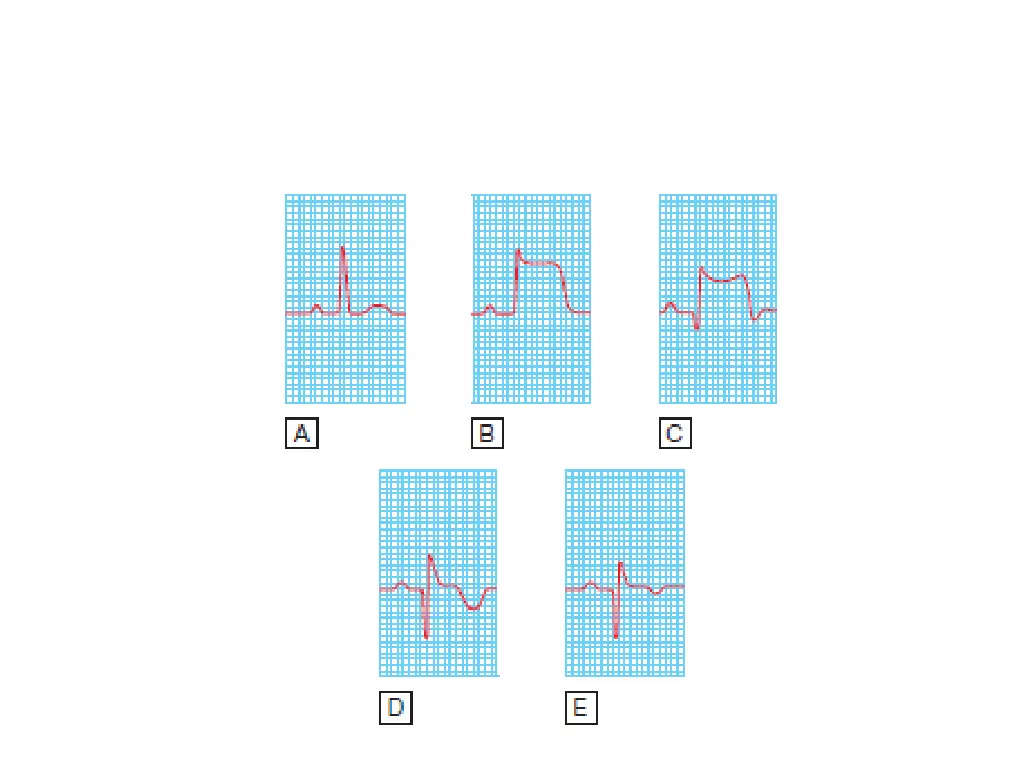 slide10