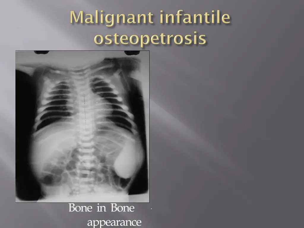 bone in bone appearance
