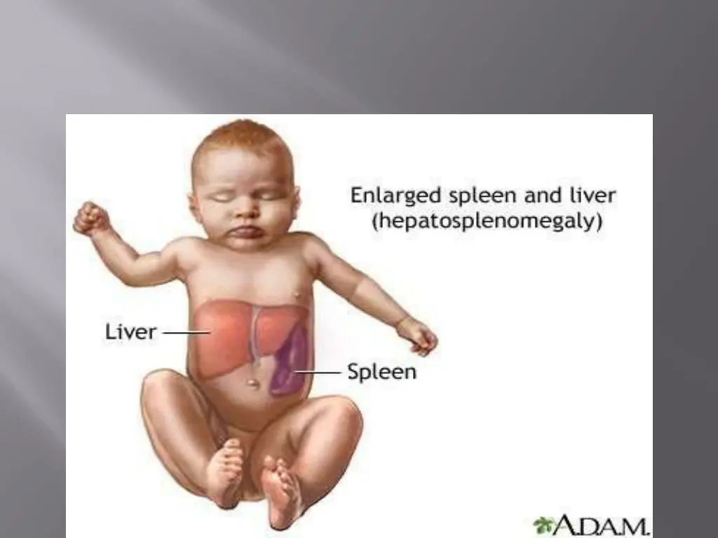 slide14