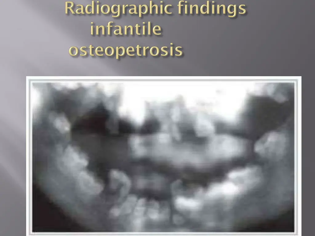 slide23