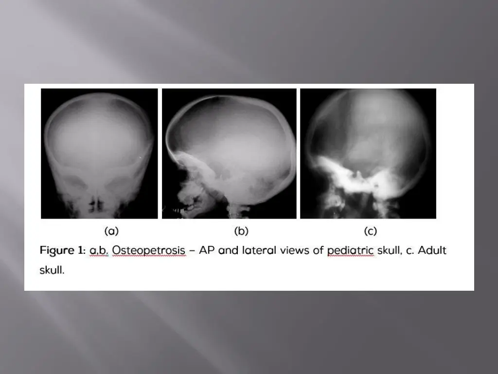 slide33