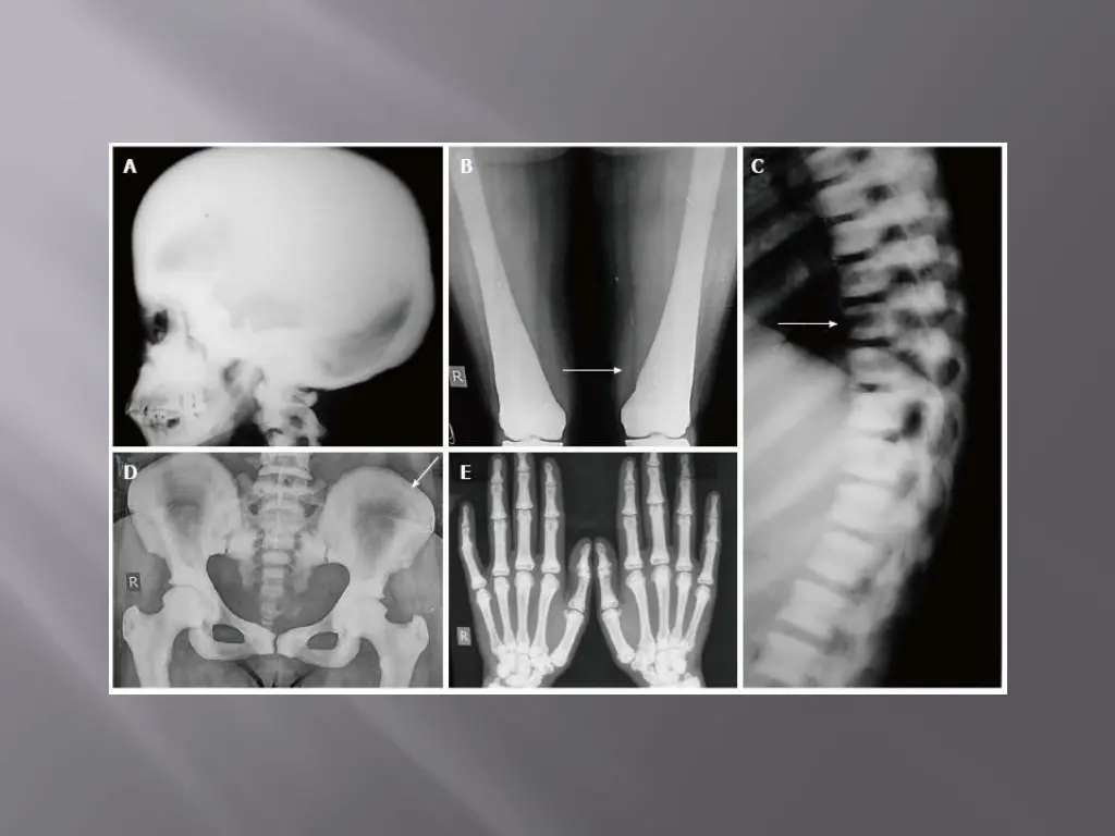 slide34
