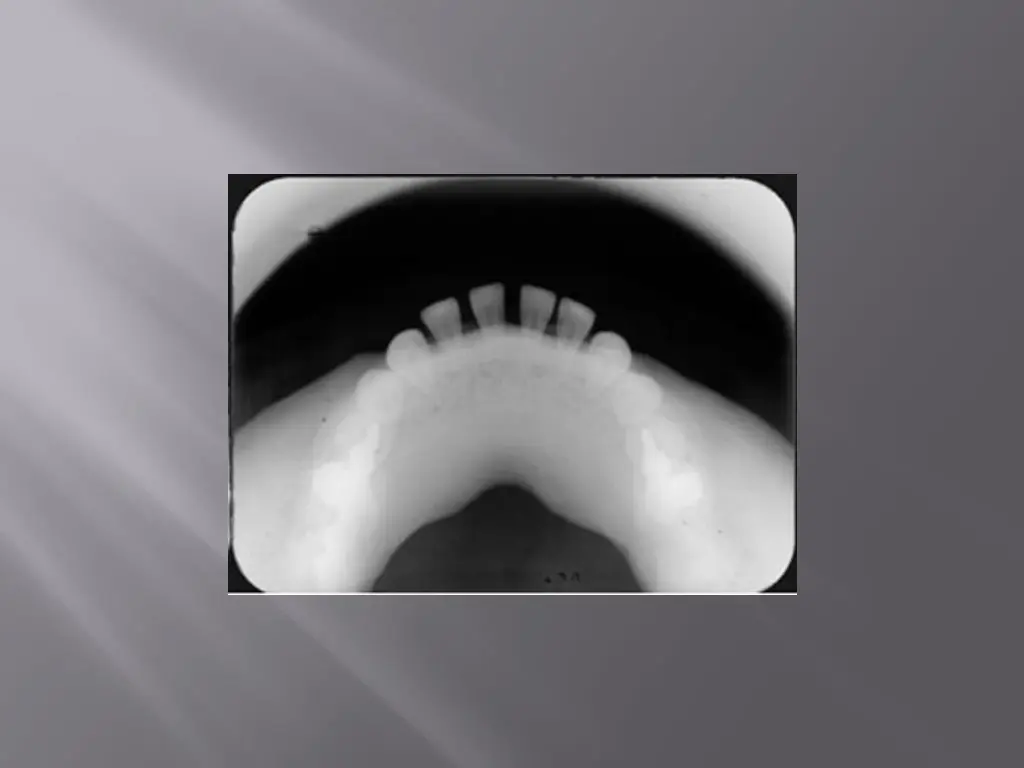 slide37