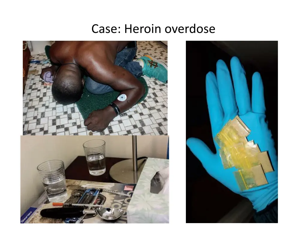case heroin overdose