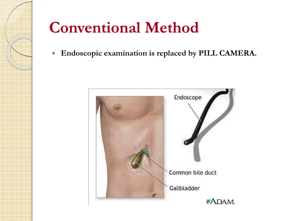conventional method