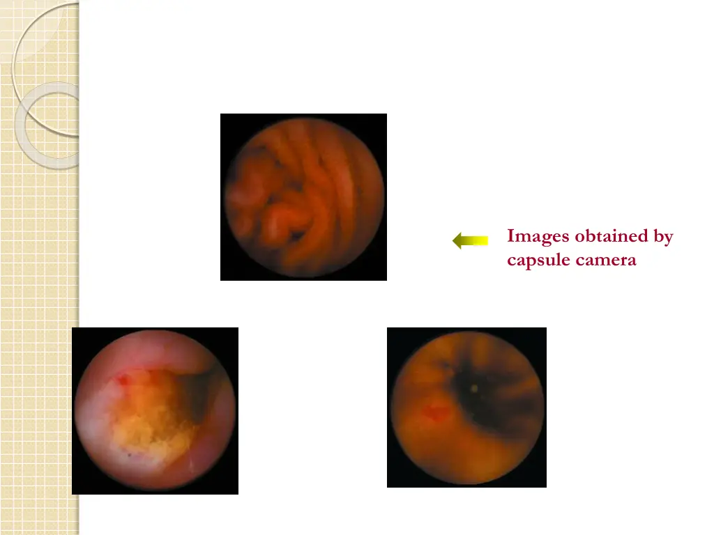 images obtained by capsule camera