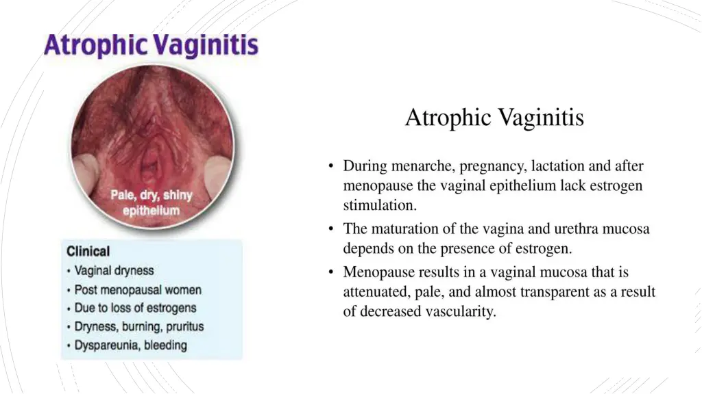 slide5
