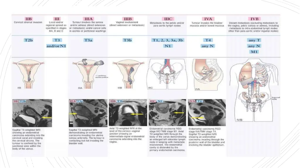 slide9