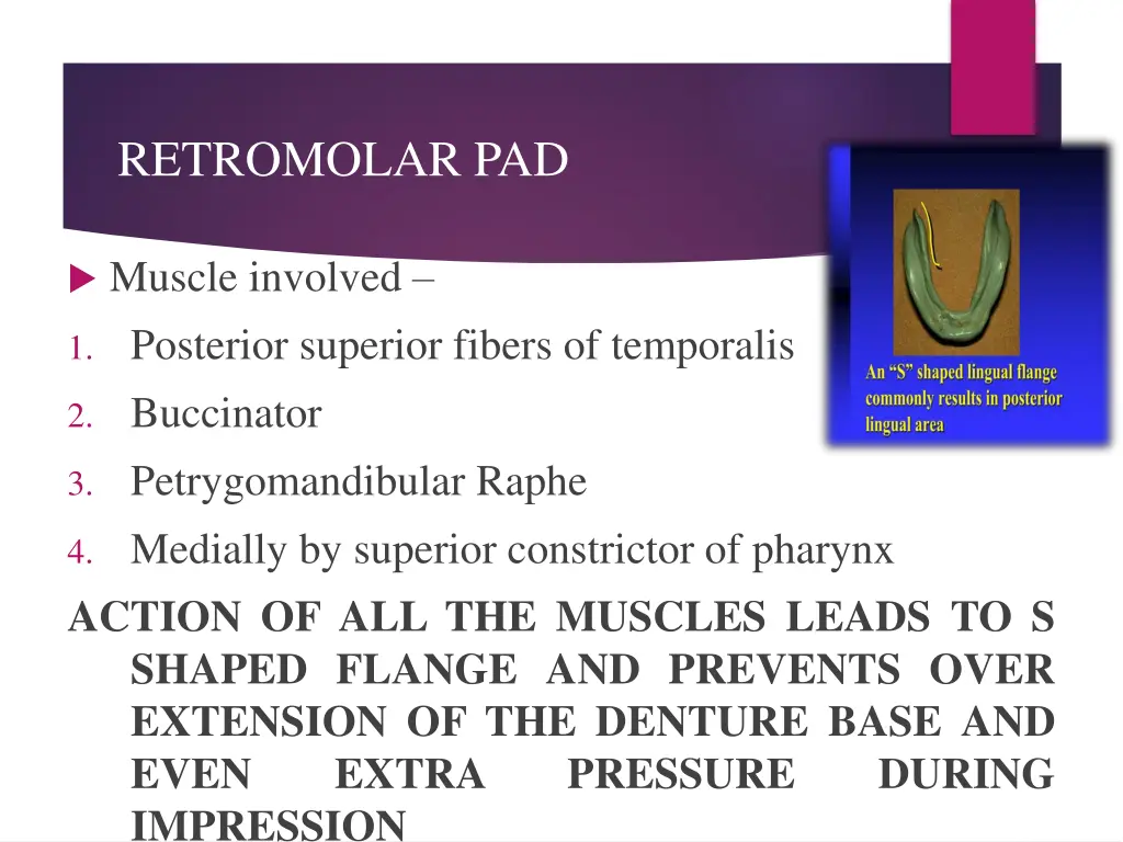 retromolar pad