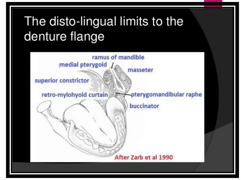 slide9