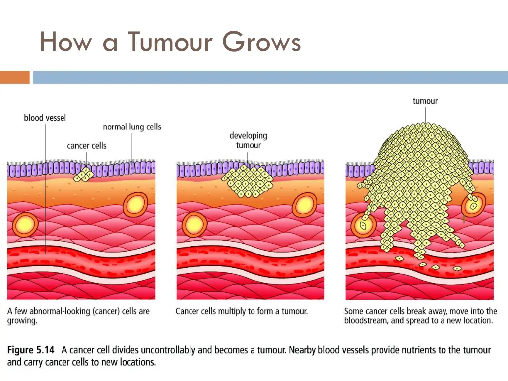 how a tumour grows