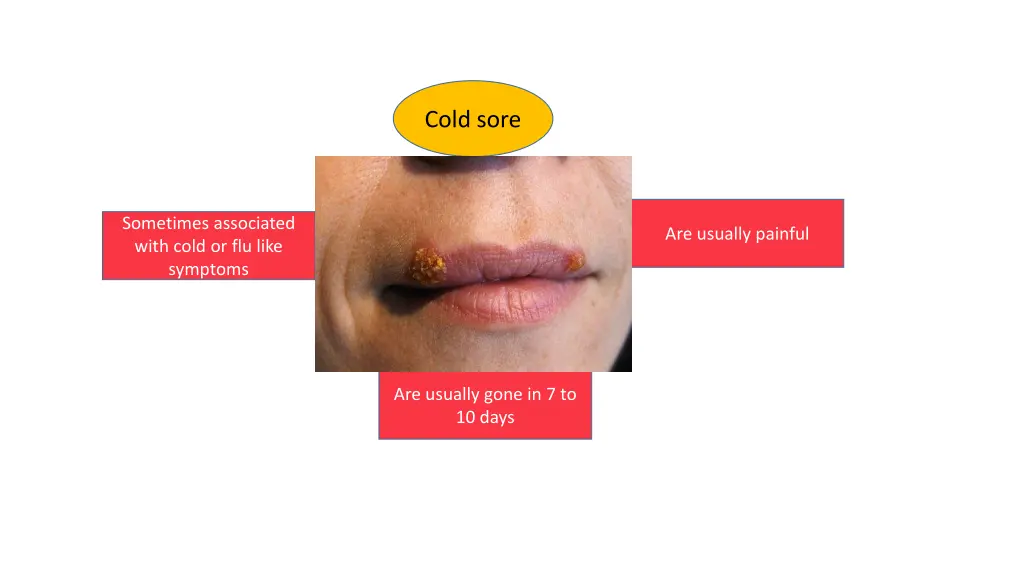 cold sore